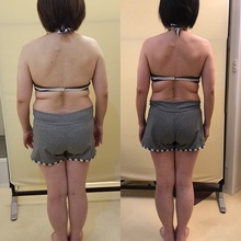 運動音痴でも大丈夫！？パーソナルトレーニングで劇的ダイエット成功！！